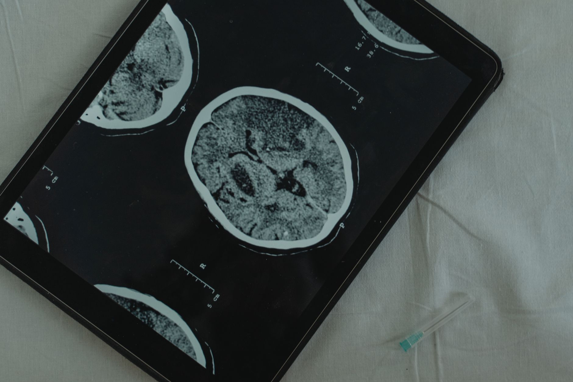 Una persona joven y atenta en una videollamada con un médico, revisando documentos de resultados de laboratorio en su computadora portátil, con una expresión de comprensión y compromiso.